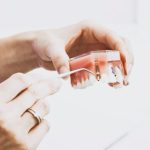 The Dental Warning Signs Most People Ignore Until It's Serious