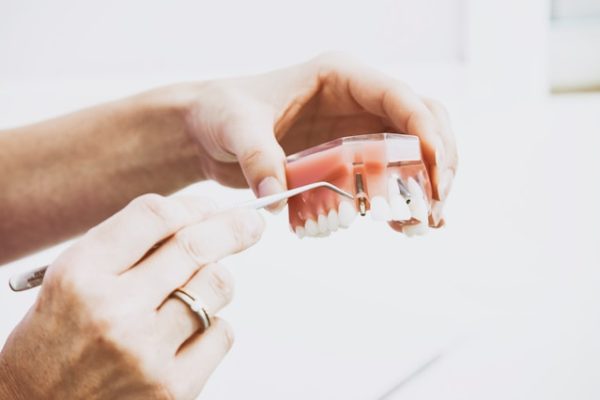 The Dental Warning Signs Most People Ignore Until It's Serious